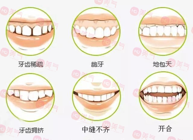 上海九院牙齒正畸哪個醫(yī)生比較好?楊一鳴、房兵醫(yī)生口碑介紹