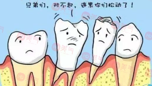 上海種植牙價格表大全更新！低至5900？內(nèi)附種植牙原理、注意事項