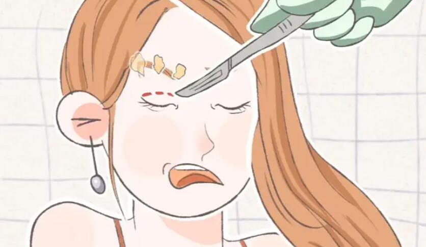 雙眼皮動漫.jpg