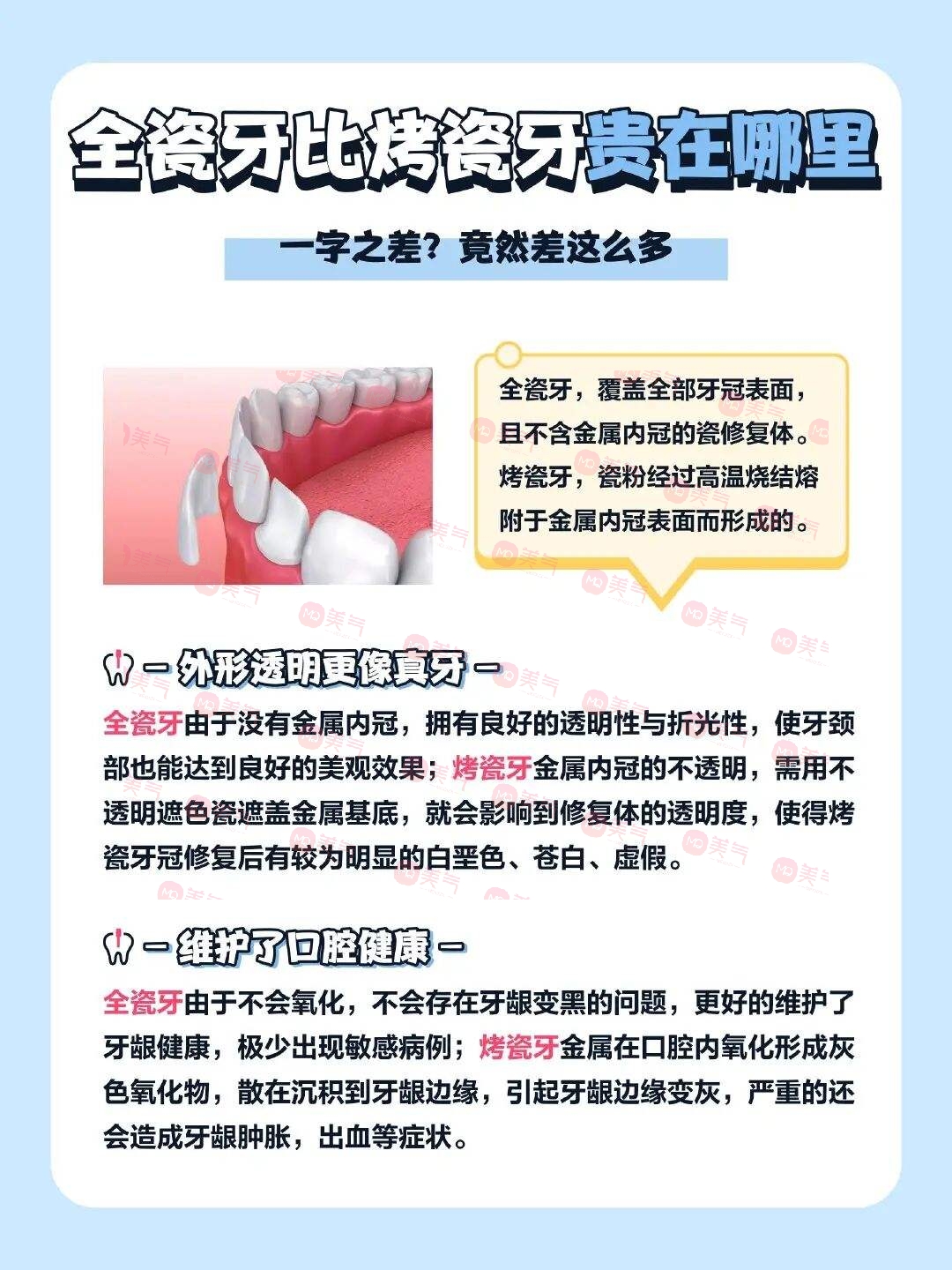 廣州全瓷牙價(jià)格多少？2023費(fèi)用明細(xì)-全瓷牙優(yōu)勢(shì)、注意事項(xiàng)附上