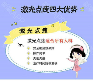 激光點痣