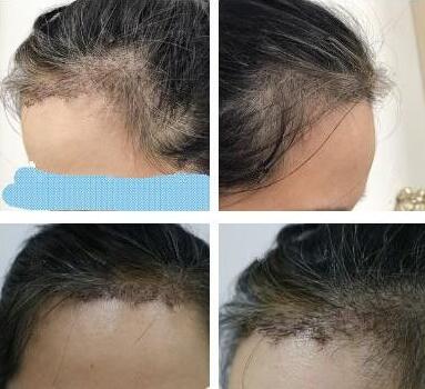 杭州格萊美醫(yī)療美容醫(yī)院怎么樣？