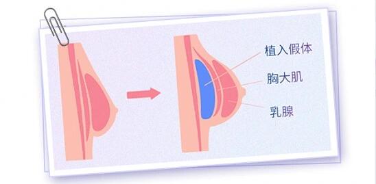 QQ截圖20231208170420.jpg