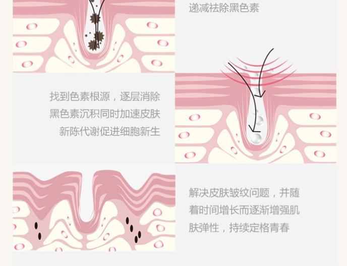 點陣激光.jpg