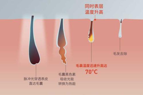 激光2.jpg
