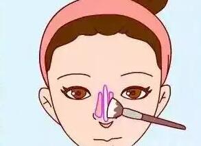 隆鼻動漫44.jpg