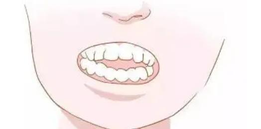 牙齒矯正hg24.jpg