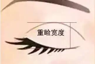 雙眼皮動漫37.jpg