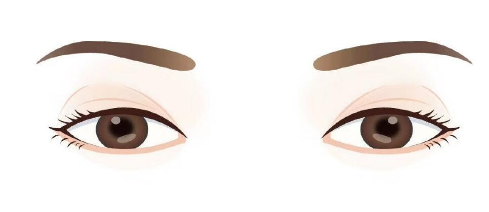 l雙眼皮i2.jpg