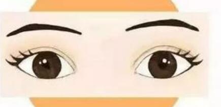 l雙眼皮y02.jpg