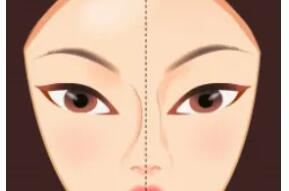 隆鼻動漫39.jpg