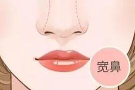 隆鼻動漫42.jpg