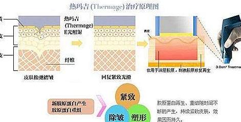 熱瑪吉h33.jpg