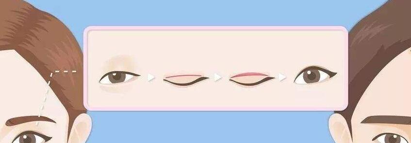 雙眼皮動(dòng)漫32.jpg