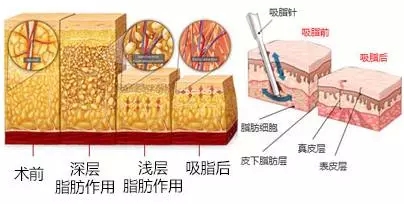 u=488484032,806331096&fm=26&gp=0.jpg