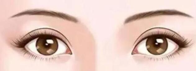 雙眼皮動(dòng)漫30.jpg