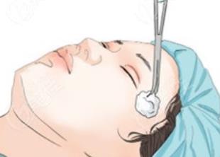雙眼皮修復(fù)動(dòng)漫h25.jpg