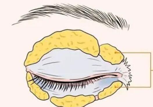 雙眼皮動漫60.jpg