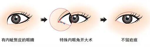 開眼角動漫12.jpg