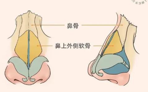 鼻修復(fù)dm01.jpg