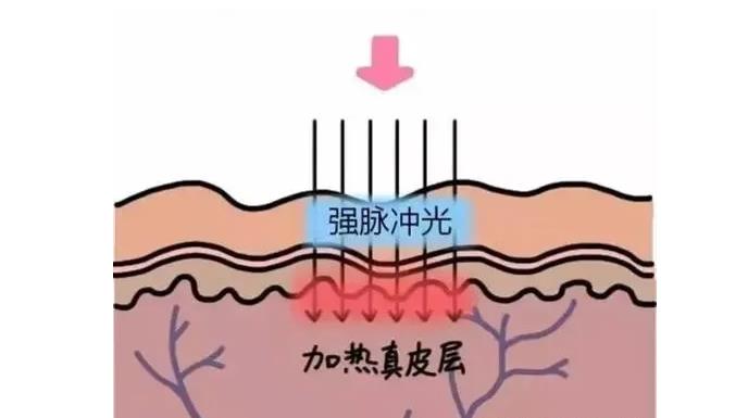 嫩膚.jpg