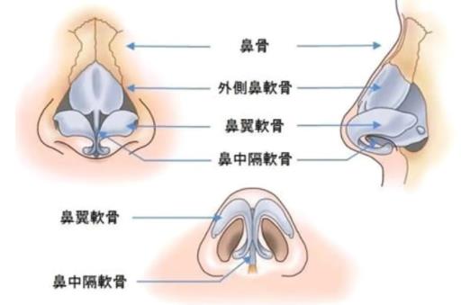 鼻修復(fù)dm02.jpg