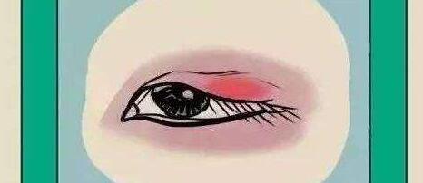 雙眼皮動(dòng)漫34.jpg