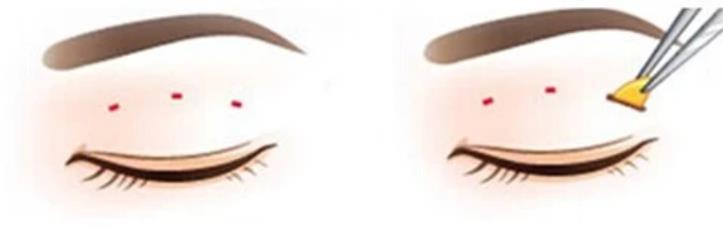 雙眼皮動漫hg1.jpg