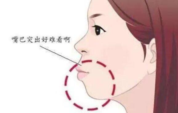 正頜.jpg