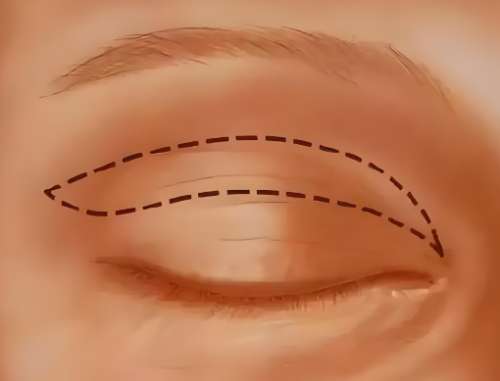 李方奇和王紹國誰的技術(shù)好？一鍵了解兩位醫(yī)生信息