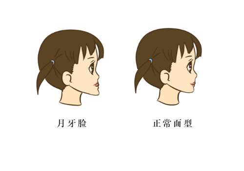 深圳市人民醫(yī)院正頜手術(shù)價格是多少?醫(yī)院信息及熱門項目曝光