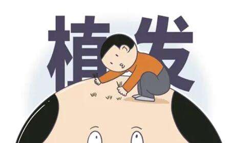 植發(fā)