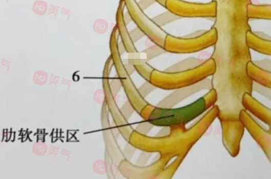 自體肋骨隆鼻的危害有哪些？手術(shù)風(fēng)險(xiǎn)、疼痛和腫脹…