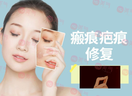 除疤痕最有效的方法，激光治療、碳酸鈣注射、纖維蛋白填充…