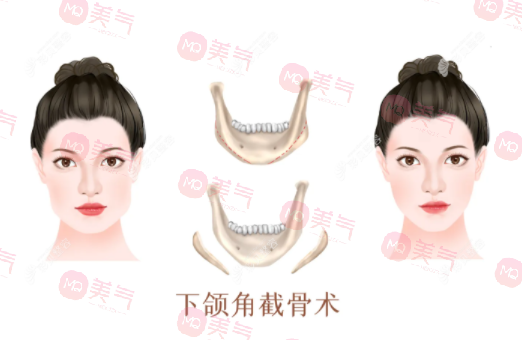 上海首爾麗格醫(yī)療美容醫(yī)院熱門(mén)項(xiàng)目