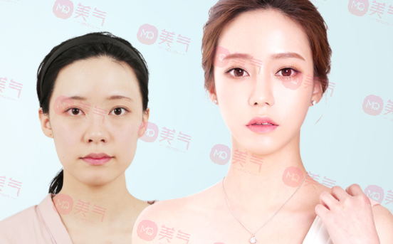北京八大處整容醫(yī)院做輪廓整形多少錢？