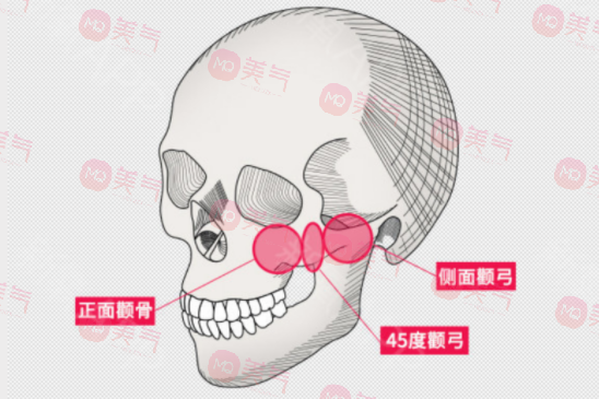 南醫(yī)大友誼磨骨費用