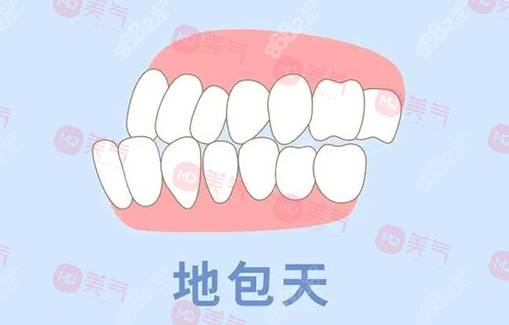 地包天矯正需要多少費用？骨性地包天整形費用2-4萬起