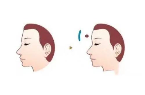 豐額頭