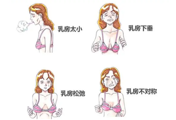 胸部修復(fù)