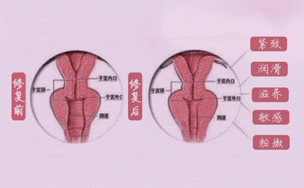 私密緊致