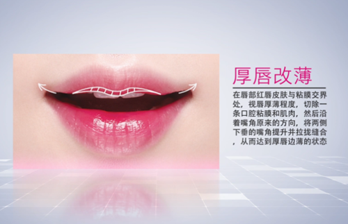 厚唇改薄